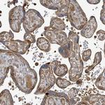 STARD4 Antibody in Immunohistochemistry (IHC)