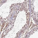 H1FNT Antibody in Immunohistochemistry (Paraffin) (IHC (P))