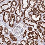 SUCLG2 Antibody in Immunohistochemistry (IHC)