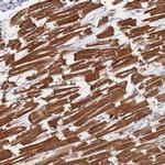 HAP40 Antibody in Immunohistochemistry (IHC)