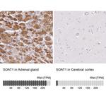 SOAT1 Antibody in Immunohistochemistry (IHC)
