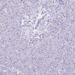 SLC23A1 Antibody in Immunohistochemistry (IHC)