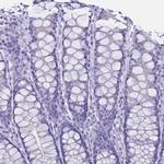 Syncollin Antibody in Immunohistochemistry (IHC)