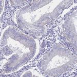 Alcohol Dehydrogenase 1A Antibody in Immunohistochemistry (Paraffin) (IHC (P))