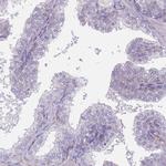 Alcohol Dehydrogenase 1A Antibody in Immunohistochemistry (Paraffin) (IHC (P))