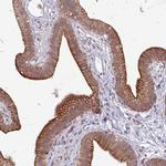 SLC15A3 Antibody in Immunohistochemistry (IHC)