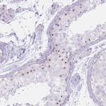 PNMA3 Antibody in Immunohistochemistry (IHC)