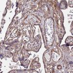 WDFY3 Antibody in Immunohistochemistry (IHC)