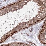 WDFY3 Antibody in Immunohistochemistry (IHC)