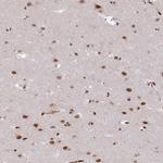 RFX1 Antibody in Immunohistochemistry (IHC)