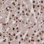 HDGF Antibody in Immunohistochemistry (IHC)