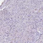 AKAP6 Antibody in Immunohistochemistry (Paraffin) (IHC (P))