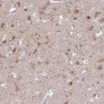 FAM69C Antibody in Immunohistochemistry (IHC)