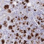 CLEC18B Antibody in Immunohistochemistry (Paraffin) (IHC (P))