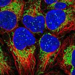 TIMM13 Antibody in Immunocytochemistry (ICC/IF)