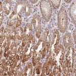 TIMM13 Antibody in Immunohistochemistry (IHC)