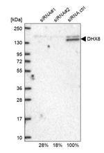 DHX8 Antibody in Western Blot (WB)