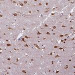 COX18 Antibody in Immunohistochemistry (Paraffin) (IHC (P))