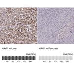 HAO1 Antibody in Immunohistochemistry (IHC)