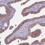 CCT6B Antibody in Immunohistochemistry (Paraffin) (IHC (P))