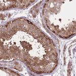 CCT6B Antibody in Immunohistochemistry (Paraffin) (IHC (P))