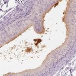 ELSPBP1 Antibody in Immunohistochemistry (IHC)