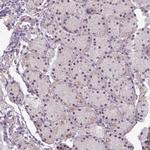 KIAA1530 Antibody in Immunohistochemistry (Paraffin) (IHC (P))