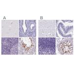 SPESP1 Antibody in Immunohistochemistry (IHC)