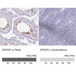 SPESP1 Antibody