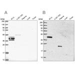 SPESP1 Antibody in Western Blot (WB)