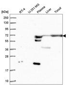 ANKRD55 Antibody in Western Blot (WB)