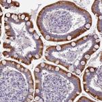 KLHL3 Antibody in Immunohistochemistry (IHC)