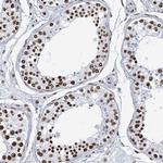 DHX16 Antibody in Immunohistochemistry (IHC)