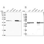 SUCLG2 Antibody in Western Blot (WB)