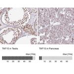 TAF15 Antibody in Immunohistochemistry (IHC)