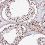 TAF15 Antibody in Immunohistochemistry (IHC)