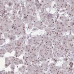 TAF15 Antibody in Immunohistochemistry (IHC)