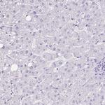 ZG16 Antibody in Immunohistochemistry (IHC)