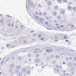 ZG16 Antibody in Immunohistochemistry (IHC)