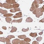 KBTBD5 Antibody in Immunohistochemistry (IHC)