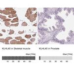 KBTBD5 Antibody