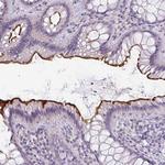 EYA3 Antibody in Immunohistochemistry (Paraffin) (IHC (P))