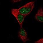 TTC30A Antibody in Immunocytochemistry (ICC/IF)