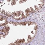 COPRS Antibody in Immunohistochemistry (IHC)