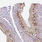 COPRS Antibody in Immunohistochemistry (IHC)