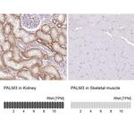 PALM3 Antibody