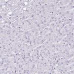 NCCRP1 Antibody in Immunohistochemistry (IHC)