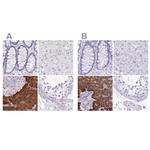 ERP27 Antibody in Immunohistochemistry (IHC)