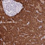 ERP27 Antibody in Immunohistochemistry (IHC)