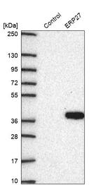 ERP27 Antibody in Western Blot (WB)